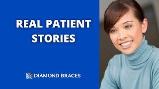 Diamond Braces Reviews - Real Patient Interviews