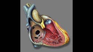 Atrio Septal Defect and Ventricular Septal Defect