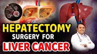 Liver Cancer: Hepatectomy Surgery | Cancer | Liver | Liver cancer treatment | Dr.Satish | Kaizen