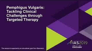 Pemphigus Vulgaris: Tackling Clinical Challenges through Targeted Therapy