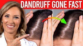 Do This To Get Rid of Dandruff FAST | Dr. Janine