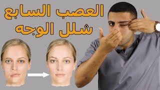 شلل الوجه النصفى أهم التمارين والستريتشات والمساج لعلاج شلل الوجه (العصب السابع)