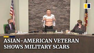 ‘Is this patriot enough?’: Asian-American veteran shows scars as he calls out anti-Asian hate