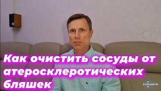 Как очистить сосуды от атеросклеротических бляшек.