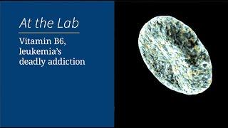 Vitamin B6, leukemia's deadly addiction