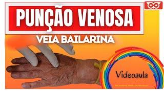 PUNÇÃO DA VEIA BAILARINA - Como fazer pra puncionar essa veia tão difícil?