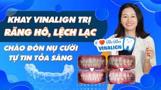 Niềng răng bằng khay Vinalign Trị Răng Hô, Lệch Lạc | Nam Bùi Vinalign