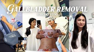 Gallbladder removal surgery vlog | surgery day, recovery process and my scars!