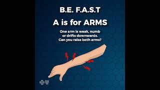 Stroke Symptoms & Warning Signs B.E. F.A.S.T. | #shorts