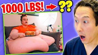 Plastic Surgeon Reacts to MY 600 LB LIFE! She went from 1000 lbs to ???