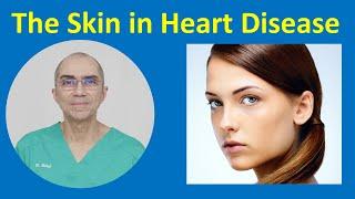 The Skin in Heart Disease: What You Need to Know