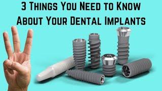 3 things you need to know about your dental implants