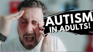 Do YOU NEED Support For Autism In Adults (MUST SEE)