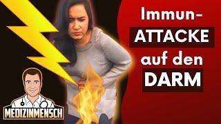 Reizdarm? Oder ATTACKIERT das Immunsystem? Bauchschmerzen Ursache erkennen (Arzt erklärt)