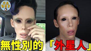 不想做男人，也不想做女人，上百次整容成功變成「外星人」｜無性別｜整容｜明星觀察員