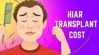 Cost of Hair Transplant in India | What is Average & Minimum Cost of Hair Transplant in India