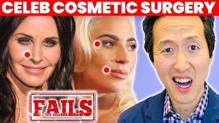 Doctor Reacts to Celebrity Plastic Surgery Fails - Dr. Anthony Youn