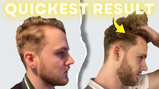 Finasteride and Minoxidil for Quickest Hair Growth Results! | AL GARRIDO