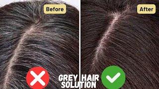 Grey Hair Homemade Solution| Remedies for Grey Hair| White Hair to Black Naturally