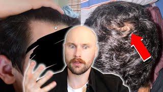 IS THIS BALDING? - Baldcafe Reacts r/balding