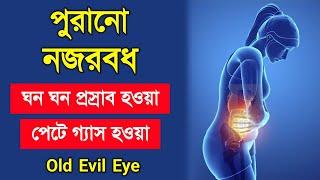 পুরানো নজরবধ এর লক্ষ্মণ এবং তার চিকিৎসা | বারবার প্রস্রাব হওয়া এবং গ্যাস হওয়া | Old Evil Eye - ik