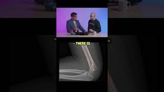 Throwback to our ODM episode where Kash and Anish go through how to interpret paediatric elbow x-ray