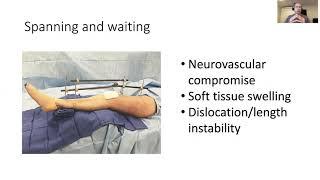 Tibial Plateau Fractures - Dr. Morshed (Part 1)