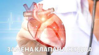 Замена сердечного клапана: как продлить жизнь своего сердца?