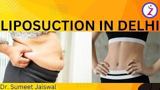 Liposuction In Delhi | Liposuction Scars | Liposuction Before and After | Lipo - Zenith Clinic