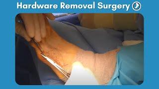 Hardware Removal Surgery