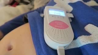 13 Weeks: "Galloping Horse" Fetal Heartbeat