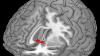 The Nucleus accumbens