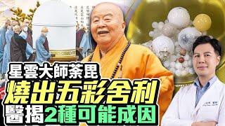 星雲大師荼毘燒出五彩舍利　醫揭2種可能成因 @ChinaTimes