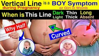 Vertical Line On Stomach During Pregnancy 🫄 |  Baby BOY or Girl Symptom in Pregnancy | Linea Nigra