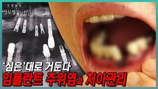 비싼 임플란트가 골칫덩이로.. 입 안의 공포 임플란트 주위염! 철저한 관리로 지키는 치아건강 | KBS 231213 방송