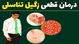 چگونه زگیل تناسلی را از بین ببریم؟| درمان زگیل تناسلی در خانه | درمان خانگی زگیل تناسلی