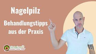 Nagelpilz   Behandlungstipps aus der Praxis