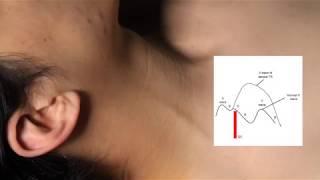 Examination of the Neck Veins Stanford Medicine 25 New 2020