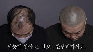 탈모 긴머리 VS 삭발 디자인된 머리 머리스타일 하나로 이미지가 이렇게 달라지나요?