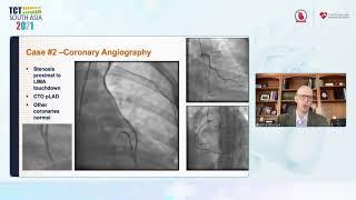 TCT 2021 | Nuclear Cardiology & Cardiac Imaging | Dr Jamieson Bourque | Arena 2 - Day 3