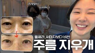 진짜로 주름이 지워지는 시술 내돈내산 리얼후기 (대받녀 중 역대급 효과..)