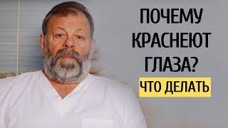 Красные глазаI Почему краснеют глаза? Покраснел 1 глаз, сосуды в глазах - что делать. Узнай причины