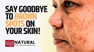 Say Goodbye to Brown Spots on Your Skin! ǀ Dr. Nick Delgado PhD