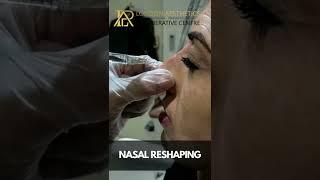 We offer a variety of invasive and non invasive aesthetic procedures.