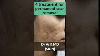 4 treatment for acne scar removal @DrArifMDDermatologist #acnescars #acnescartreatment