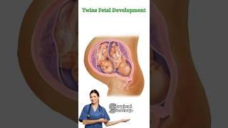 Twins Fetal Development #pregnancy #twinsbaby #pregnancycare