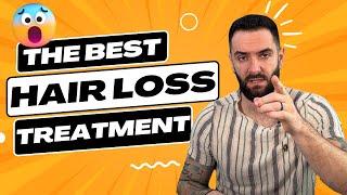 What Is the Best Hair Loss Treatment?