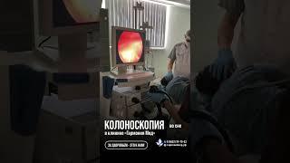 колоноскопия под наркозом  #гармония #колоноскопияподнаркозом #врач