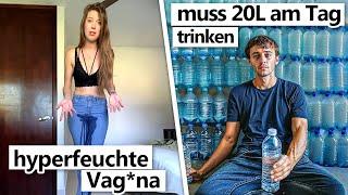 7 Menschen mit einmaligen medizinischen Konditionen