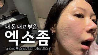 피부과의사들의 단골 추천시술? 피부영양제 엑소좀상담부터 시술,전후사진,부작용 까지! (대받녀)